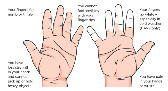 [Image] diagram showing symptoms of Havs and CTS